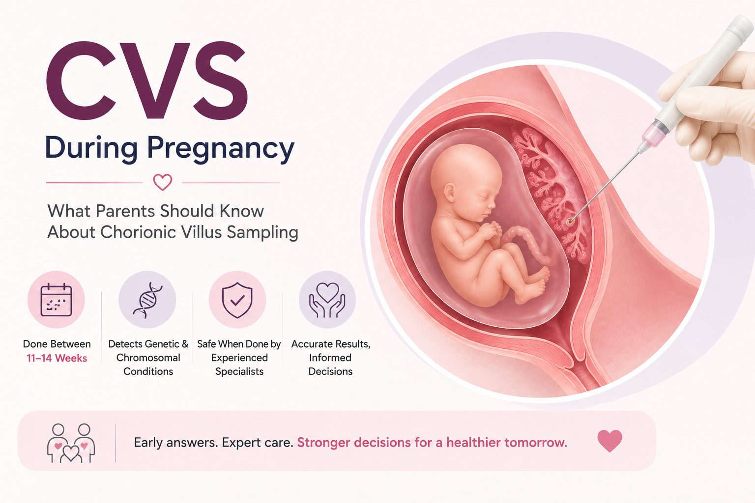 CVS During Pregnancy: What Parents Should Know About Chorionic Villus Sampling article illustration for Mom & Me Fetal Medicine Centre