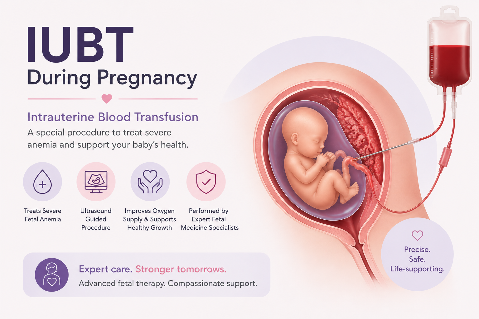 IUBT During Pregnancy: What Parents Should Know About Intrauterine Blood Transfusion article illustration for Mom & Me Fetal Medicine Centre