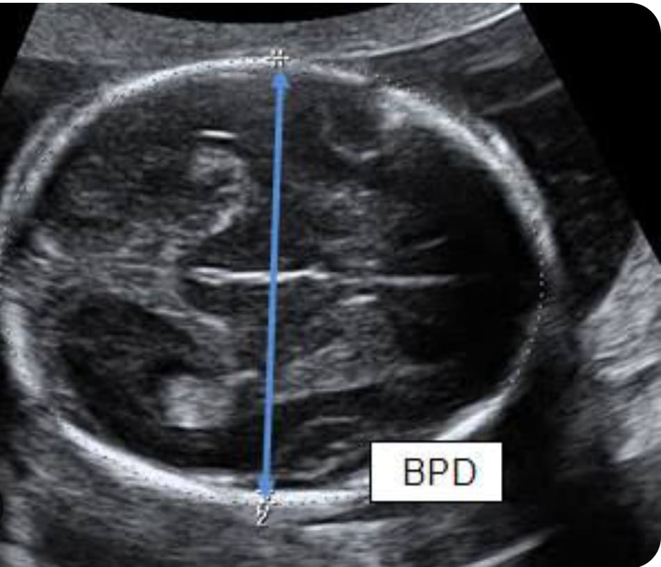 Growth Scan